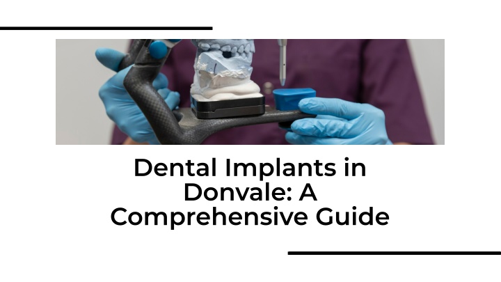 dental implants in donvale a comprehensive guide n.w