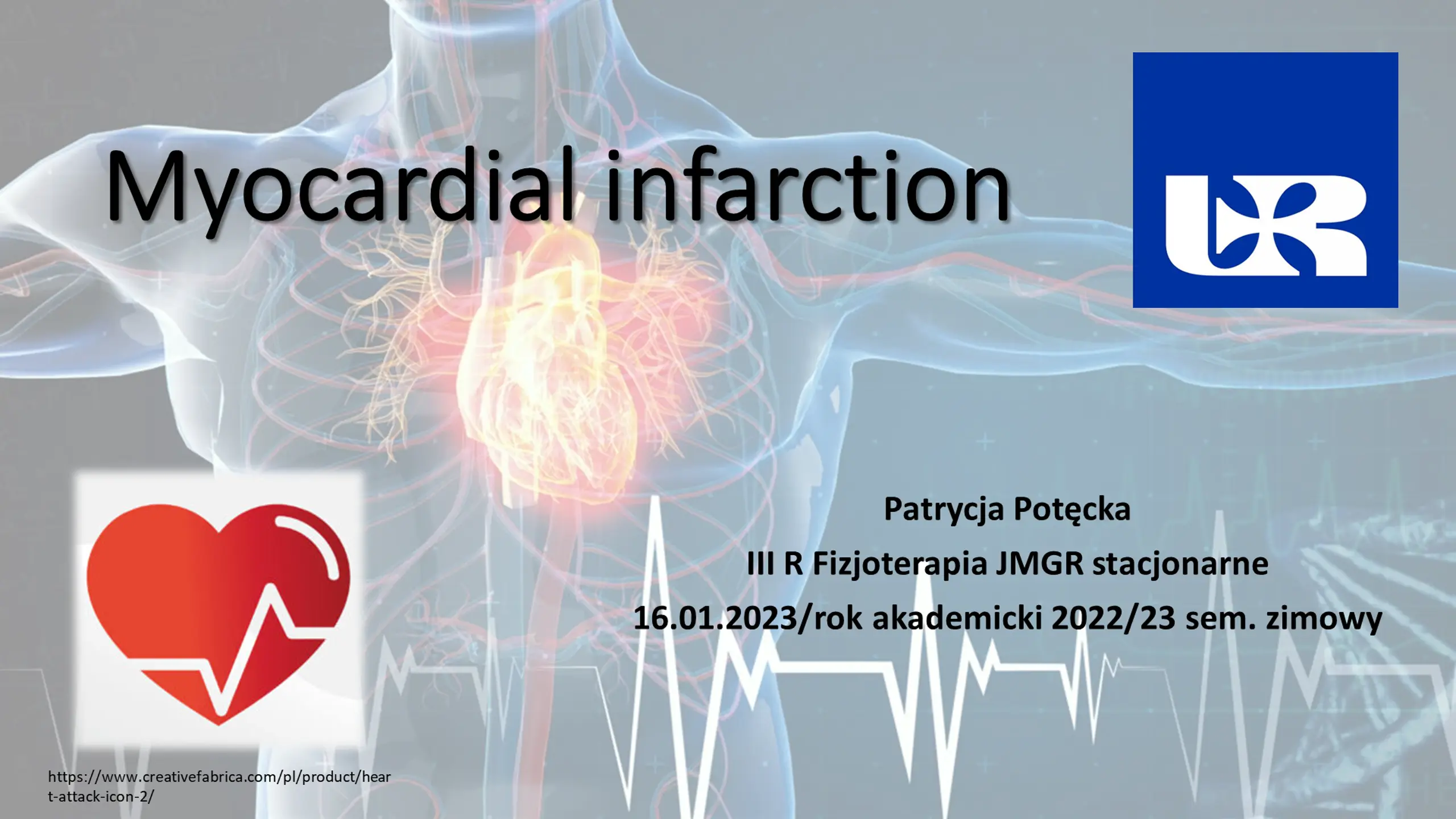 Myocardial infarction