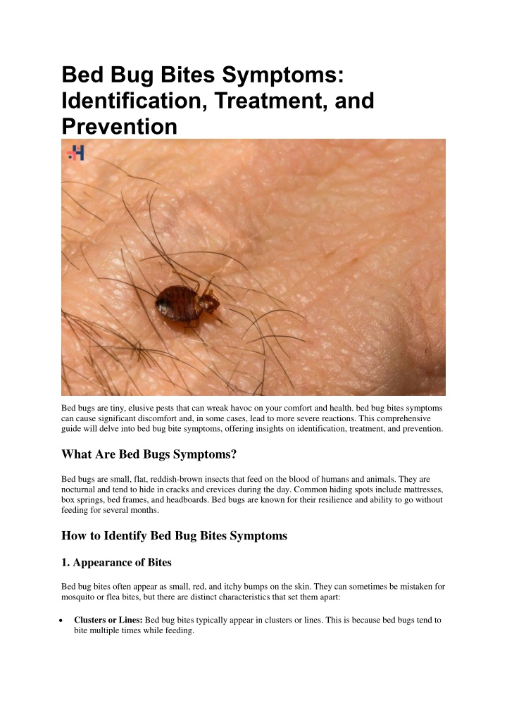 bed bug bites symptoms identification treatment n.w