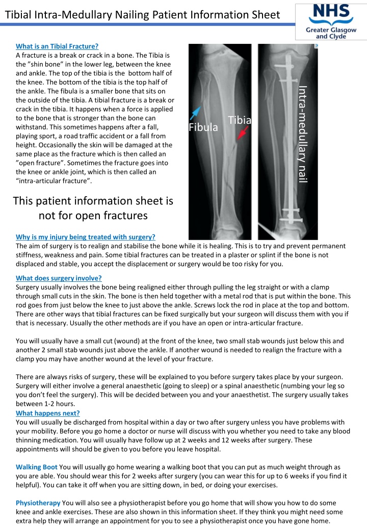 Tibial Intra-Medullary Nailing Patient Information