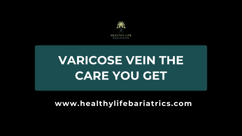 varicose vein the care you get l.w