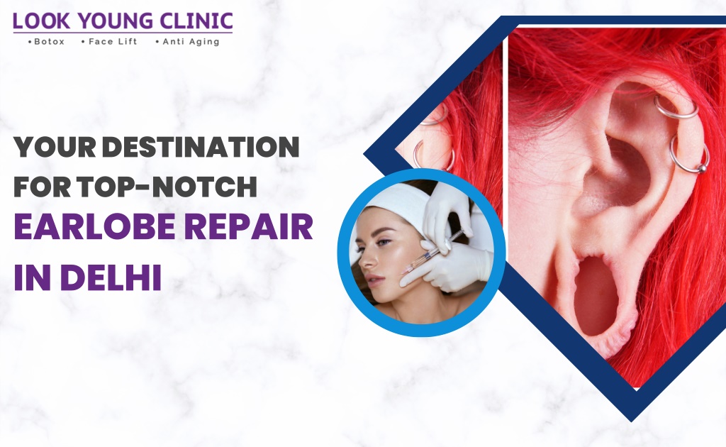 your destination for top notch earlobe repair l.w