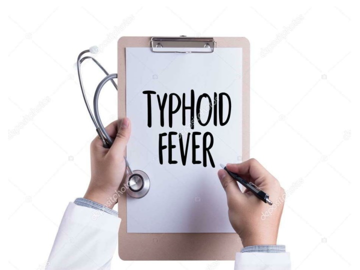 Enteric Fever (Typhoid Fever): Causes, Contagiousness, and Prognosis