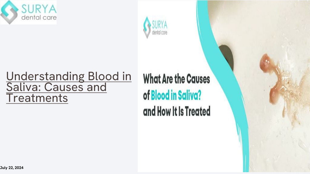 understanding blood in saliva causes l.w