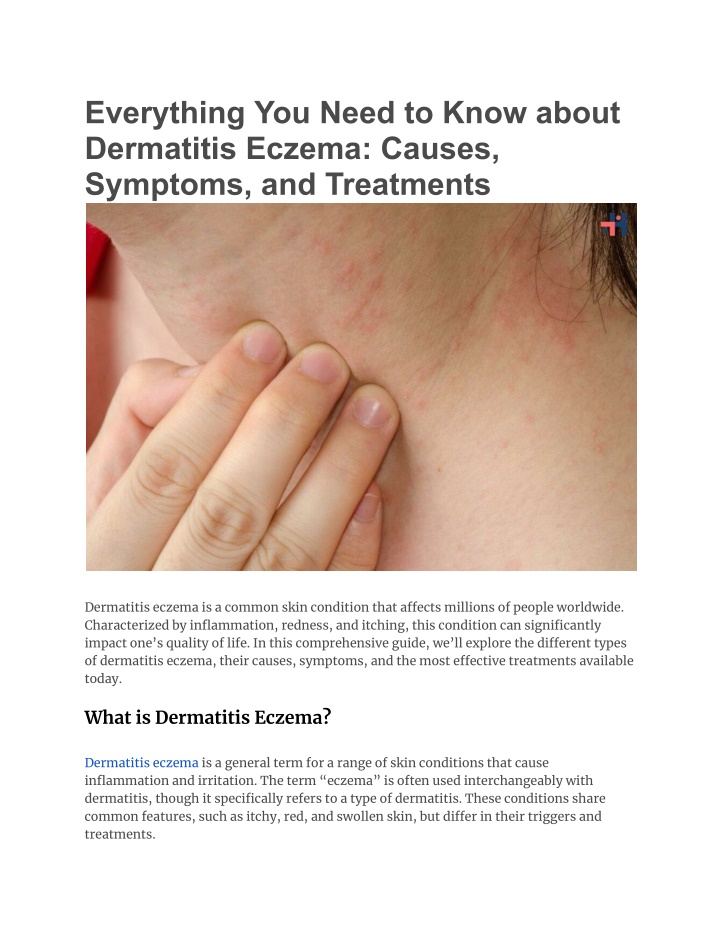 everything you need to know about dermatitis n.w