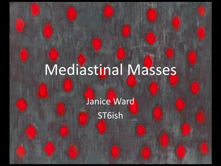 Mediastinal Masses: A Comprehensive Visual Guide