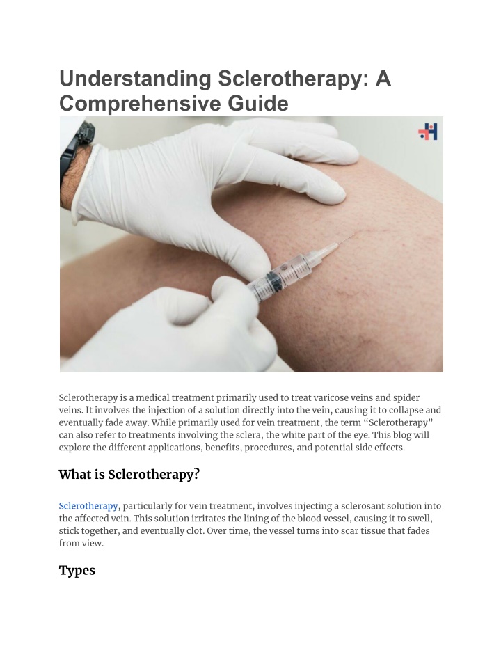 understanding sclerotherapy a comprehensive guide n.w