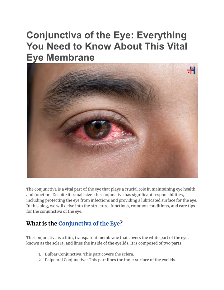 conjunctiva of the eye everything you need n.w