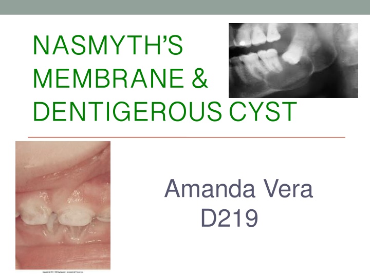Nasmyth's Membrane and Dentigerous Cysts in Dental Health