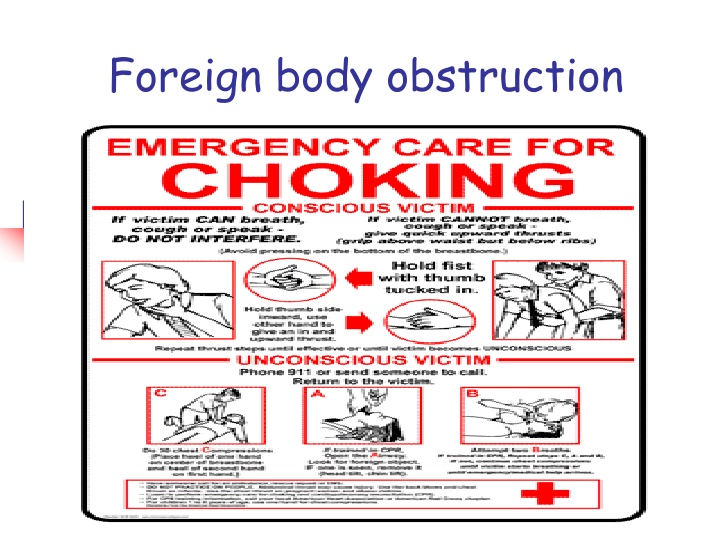 First Aid for Foreign Body Obstruction: Causes, Signs, and Management