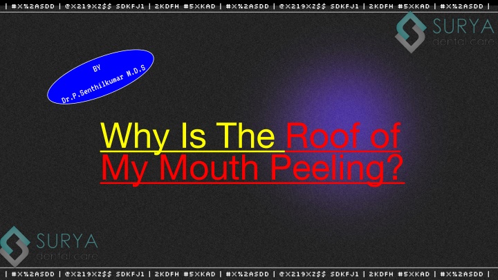 Roof of mouth peeling - Surya Dental PPT