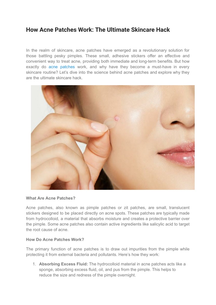 how acne patches work the ultimate skincare hack n.w