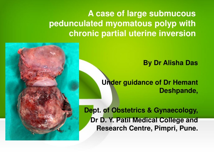 Large Submucous Pedunculated Myomatous Polyp with Chronic Partial Uterine Inversion