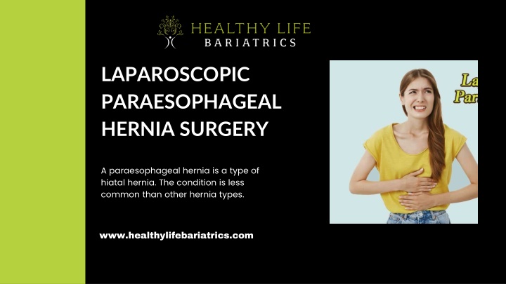 Laparoscopic Paraesophageal Hernia Surgery in Los Angeles CA