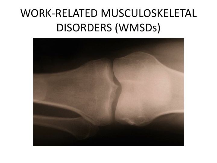 Work-Related Musculoskeletal Disorders (WMSDs)