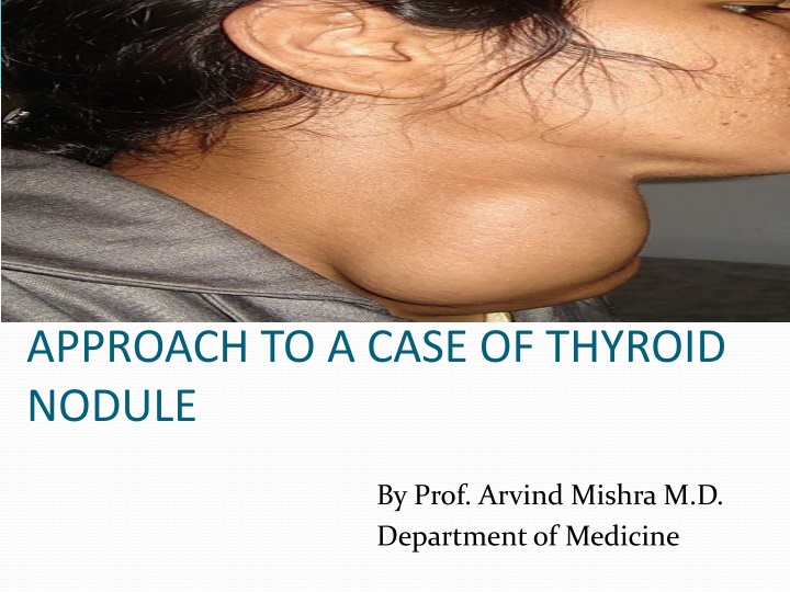 Approach to a Thyroid Nodule: Causes, Diagnosis, and Management