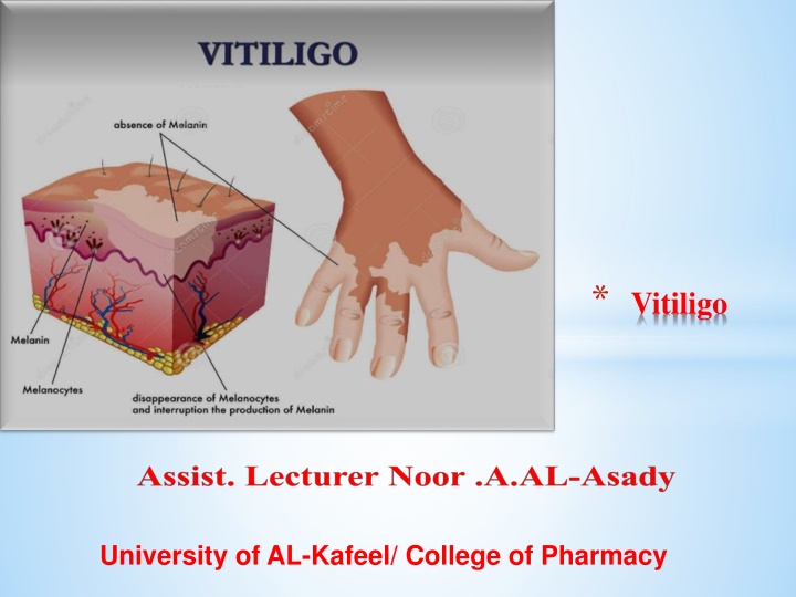 Vitiligo: Causes, Symptoms, and Treatments