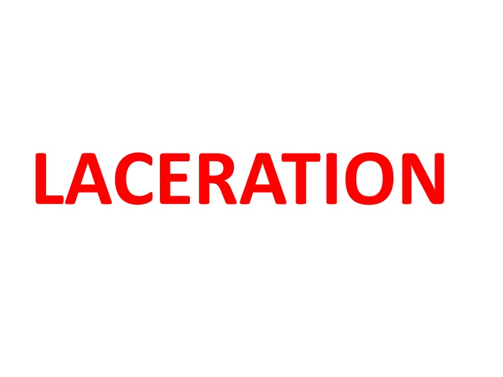 Lacerations: Causes and Types