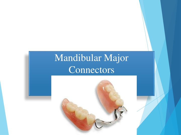 Mandibular Major Connectors in Dentistry