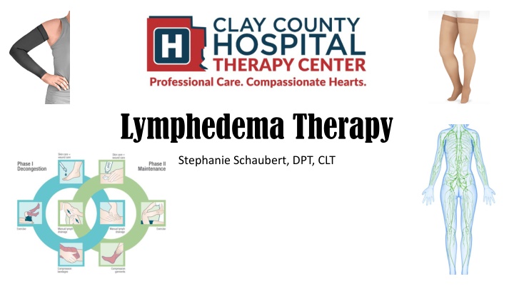 Lymphedema Therapy and Treatment Options