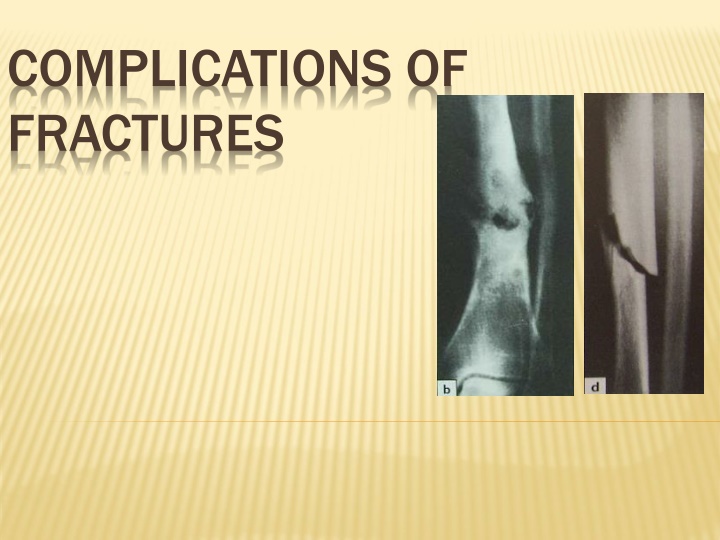 Complications of Fractures: Types and Risks