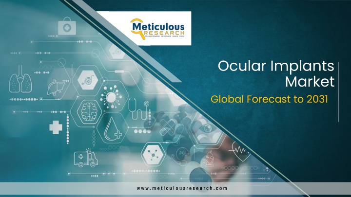 ocular implants n.w