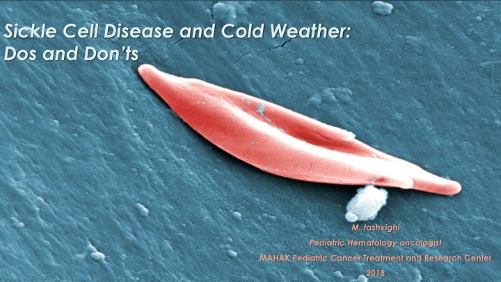 The Impact of Cold Weather on Sickle Cell Disease
