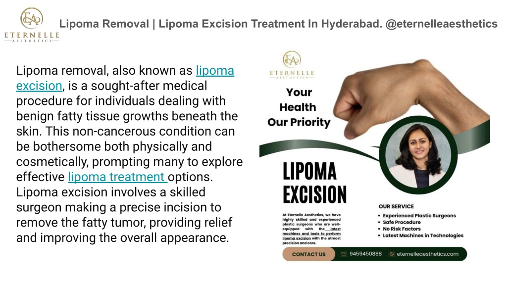 lipoma removal lipoma excision treatment l.w