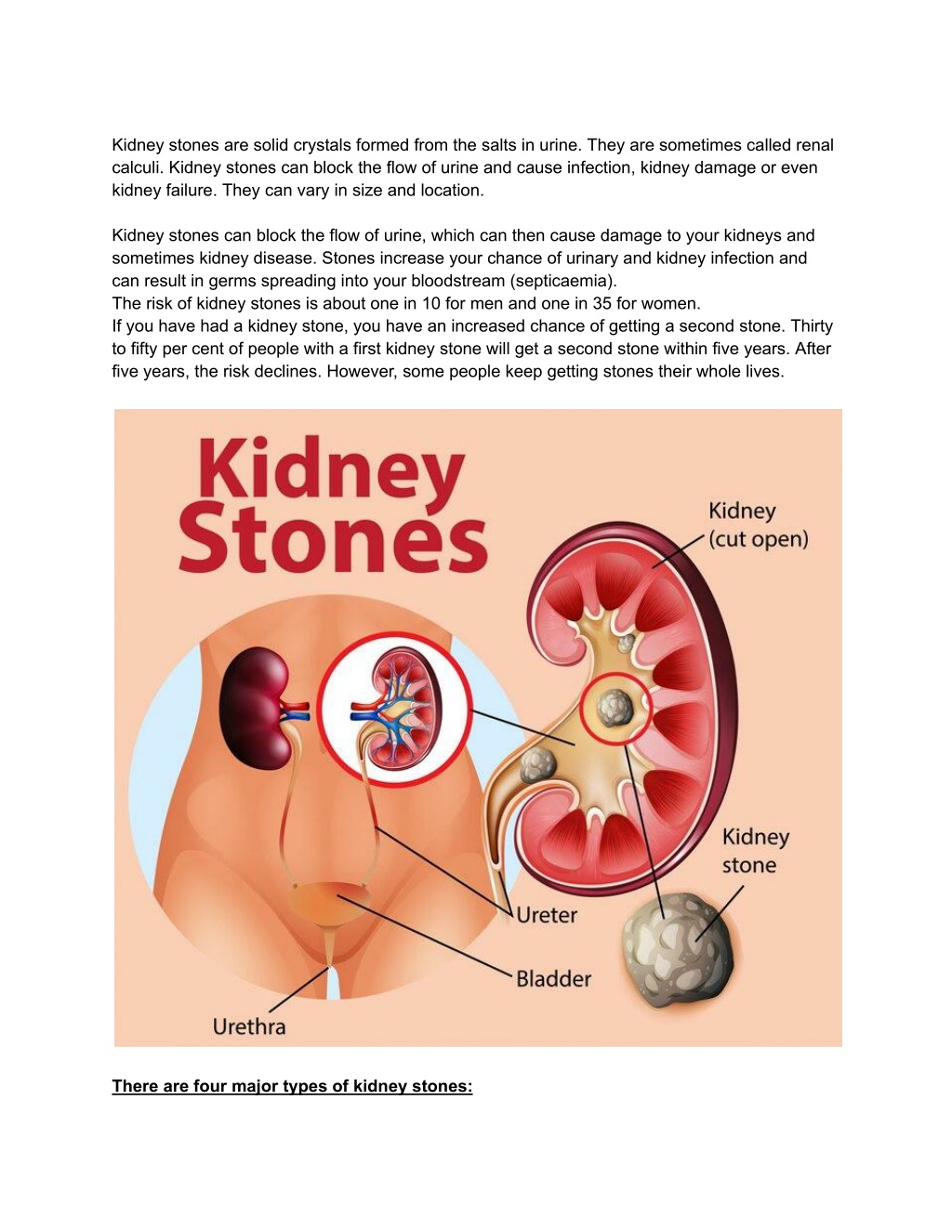 kidney stones are solid crystals formed from l.w