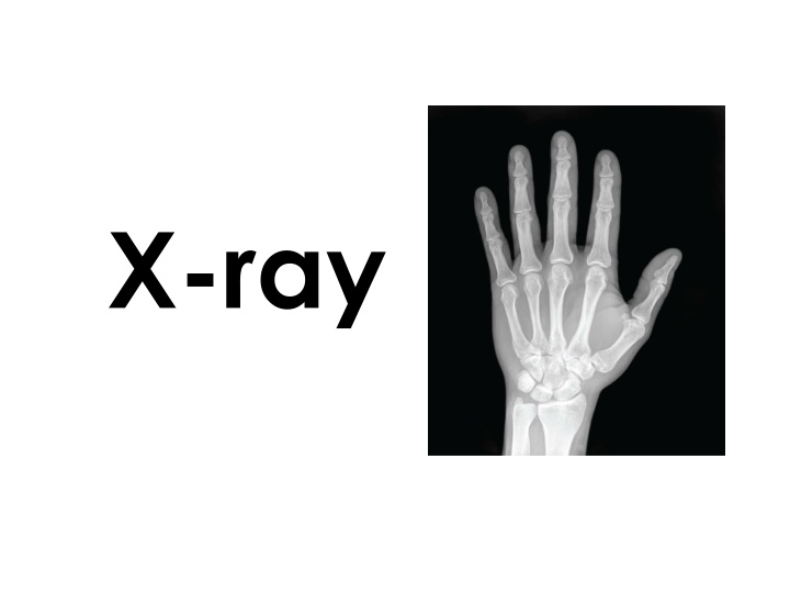 Exploring X-ray Imaging Technology in Healthcare