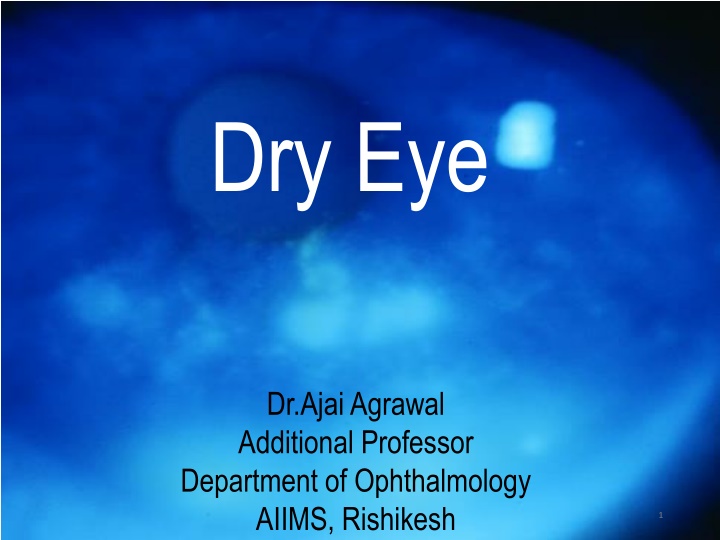 Dry Eye Disease: Causes, Symptoms, and Management