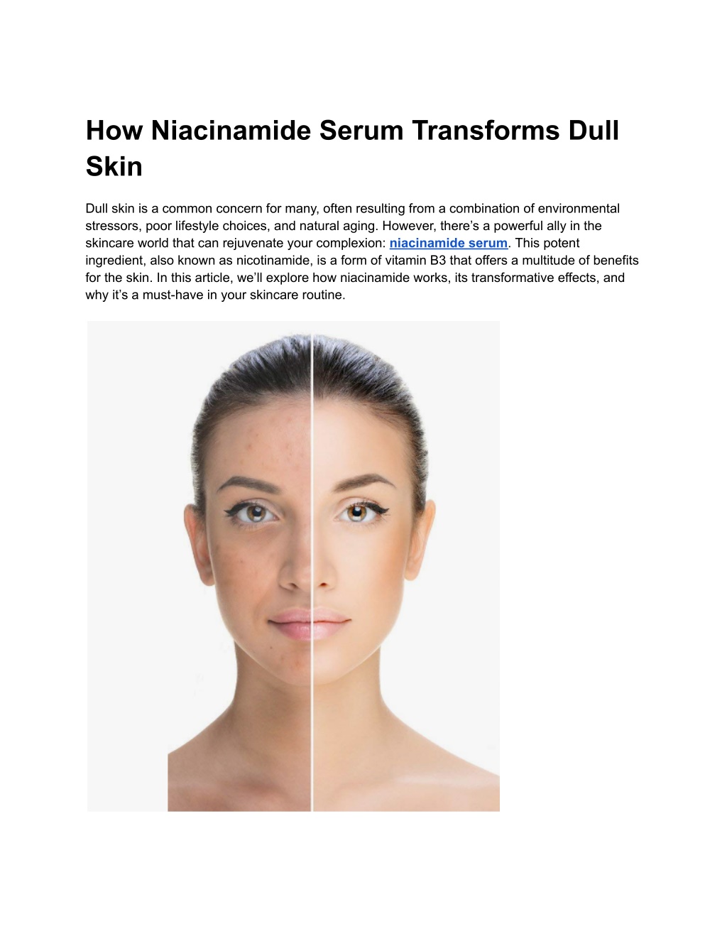 how niacinamide serum transforms dull skin l.w