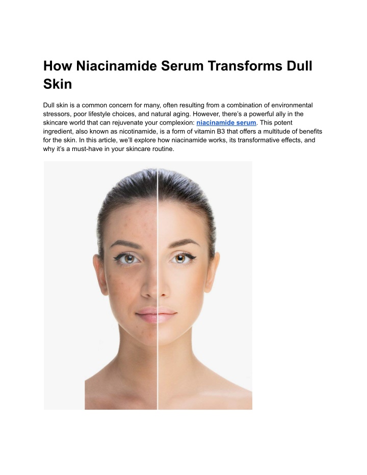 how niacinamide serum transforms dull skin n.w