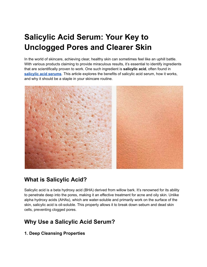 salicylic acid serum your key to unclogged pores n.w