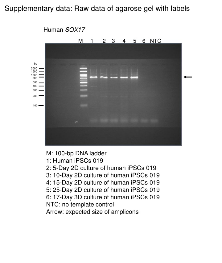 Raw Data of Agarose Gel for Human Gene Expression Analysis