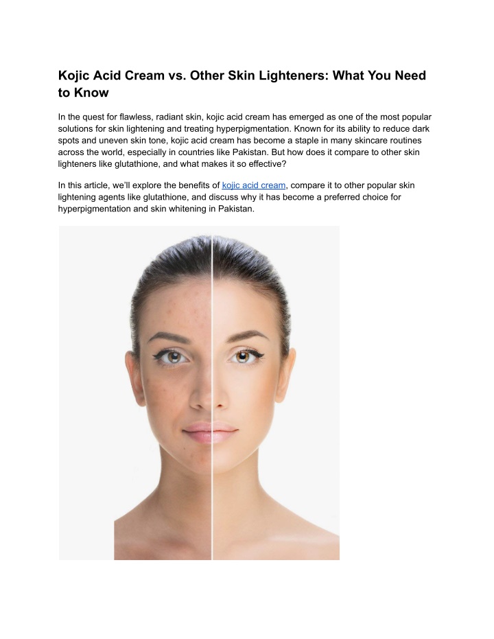 kojic acid cream vs other skin lighteners what n.w