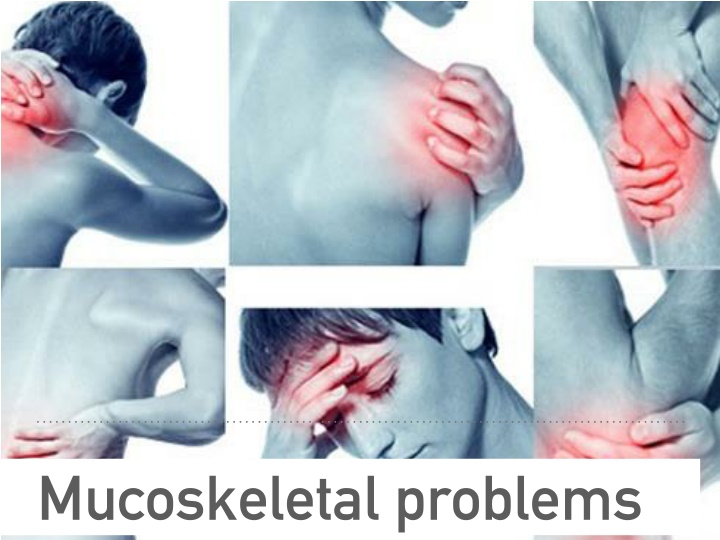 Musculoskeletal Problems and Injuries