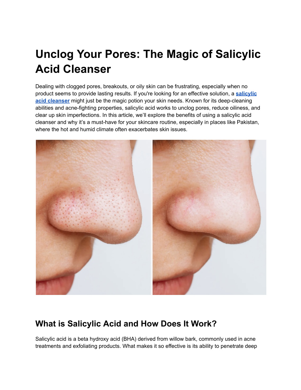 unclog your pores the magic of salicylic acid l.w