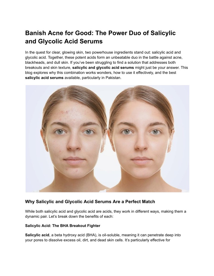 banish acne for good the power duo of salicylic n.w