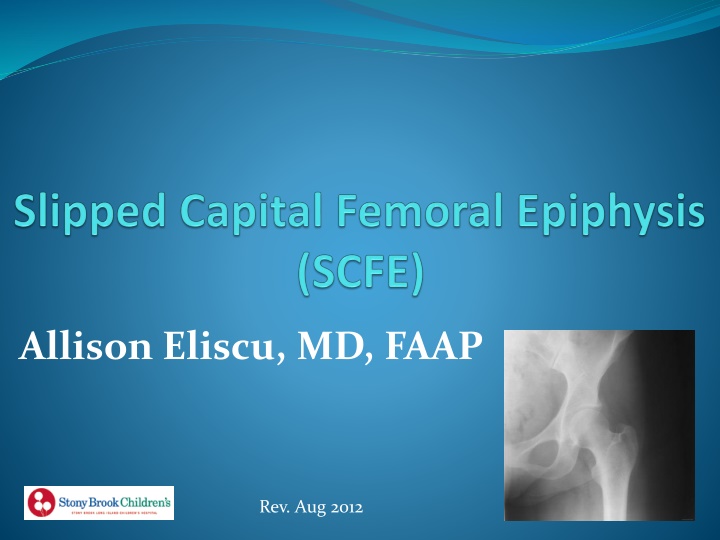 SCFE (Slipped Capital Femoral Epiphysis) in Adolescents