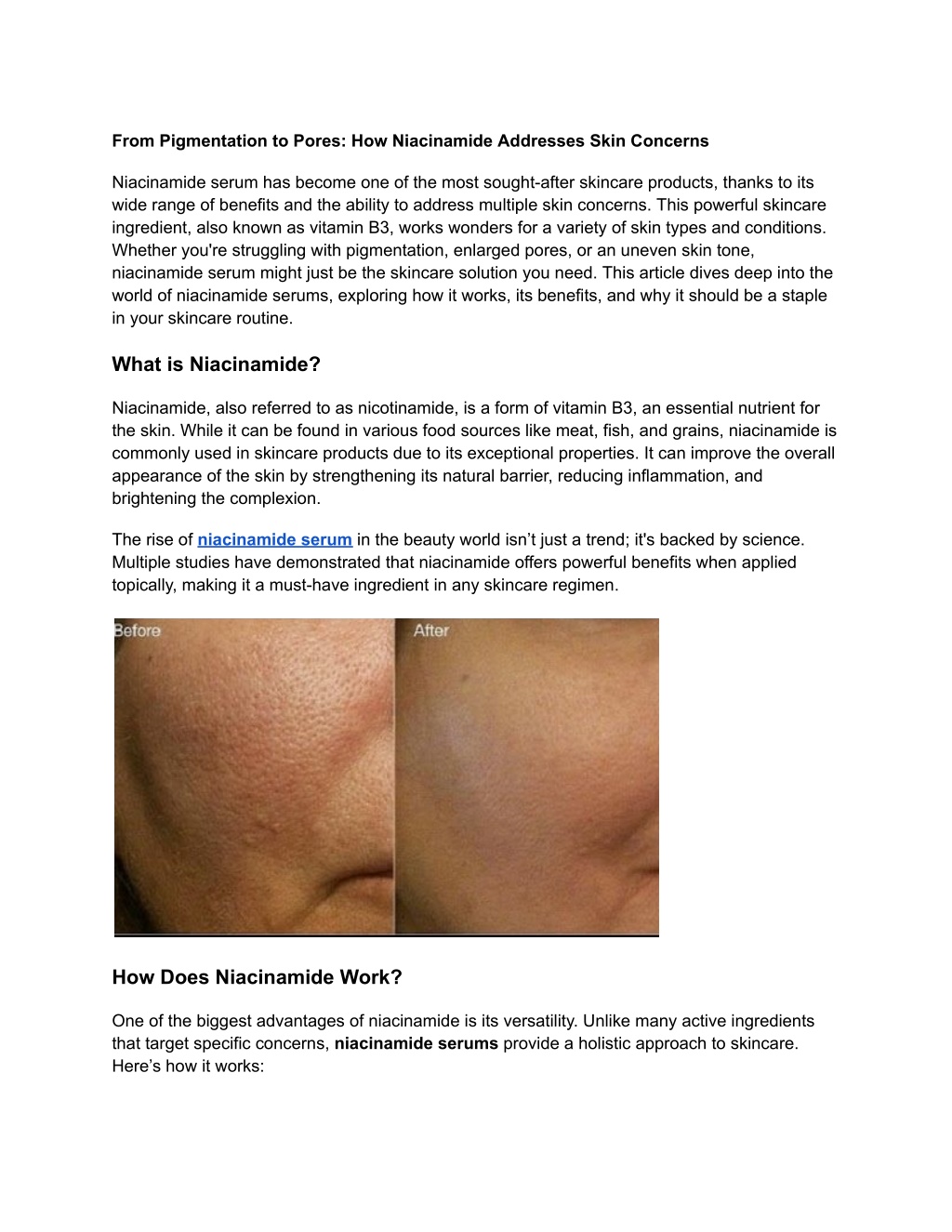 from pigmentation to pores how niacinamide l.w