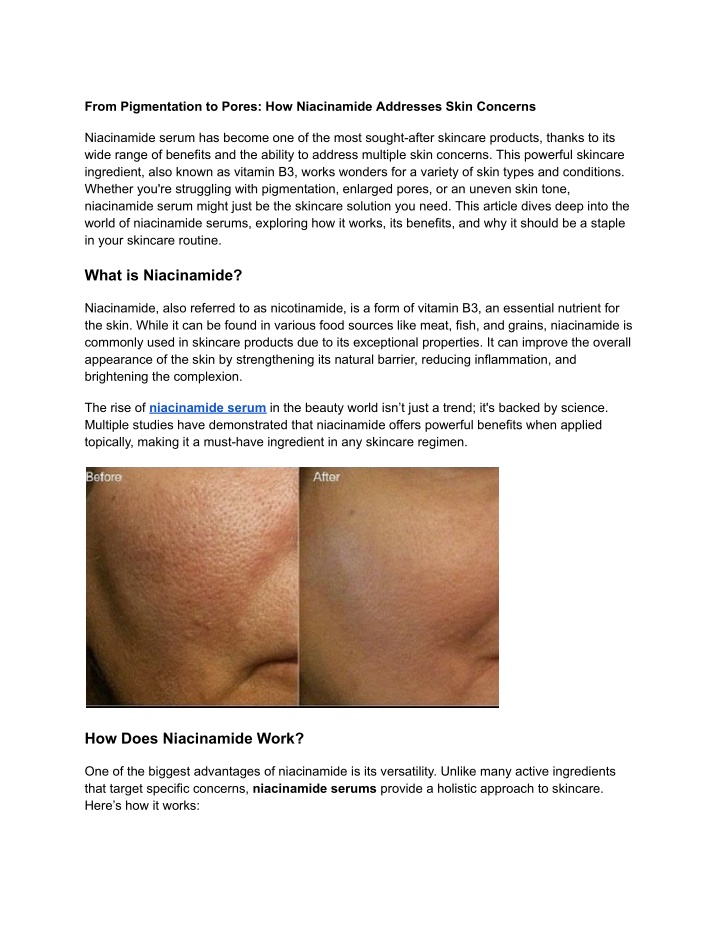 from pigmentation to pores how niacinamide n.w