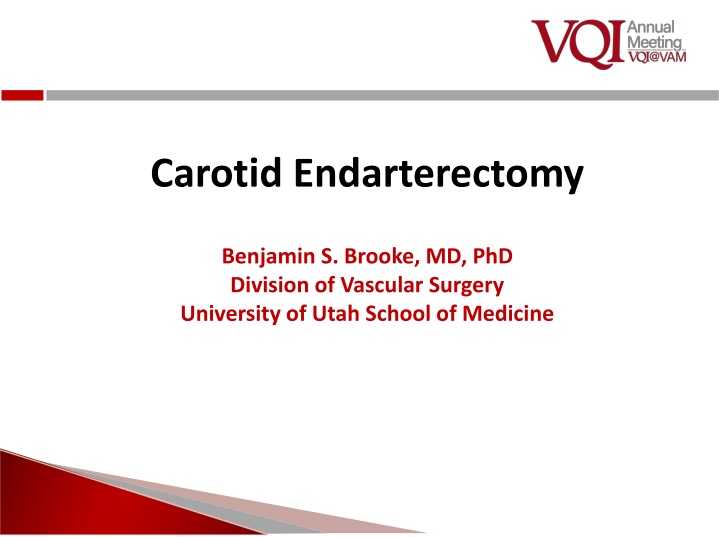 Carotid Endarterectomy Review and Case Discussion