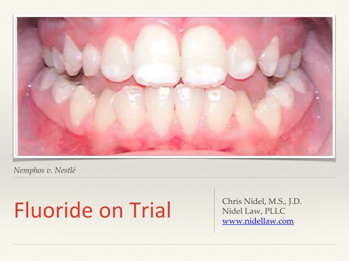 Legal Case: Nemphos v. Nestlé - Claims Regarding Dental Fluorosis