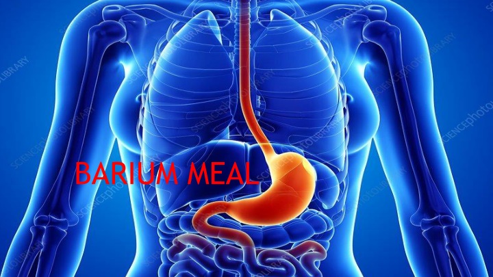 Barium Meal Radiological Study