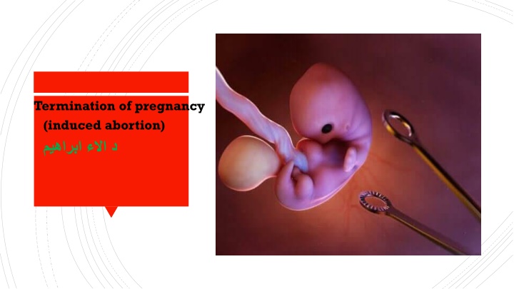 Termination of Pregnancy: Indications, Methods, and Complications