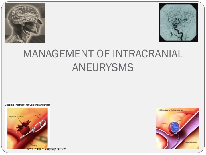 The Management of Intracranial Aneurysms
