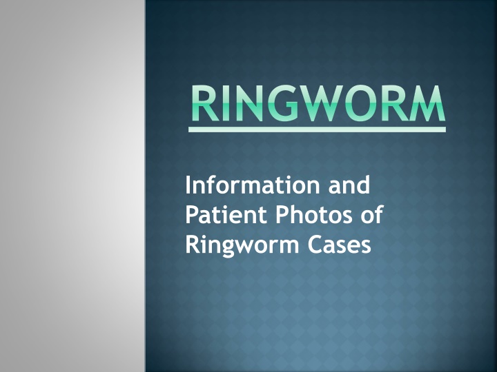 Ringworm: Causes, Types, and Treatment