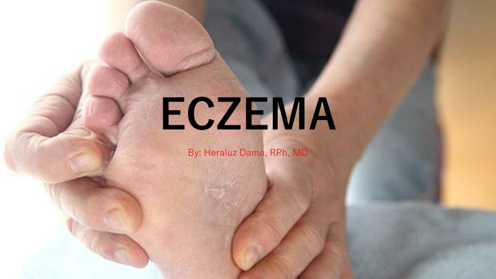 Eczema: Causes, Classifications, and Pathogenesis