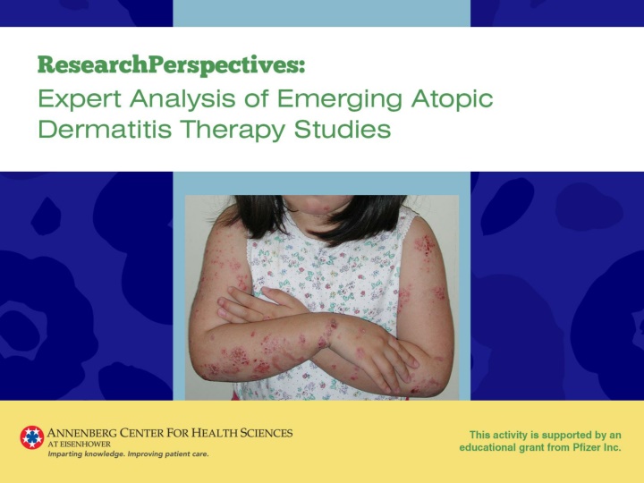 Comparative Analysis of Crisaborole Ointment and Dupilumab in Atopic Dermatitis